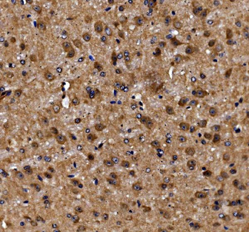 ADRM1/ARM-1/ARM Rabbit Polyclonal Antibody