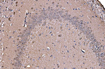 ADRM1/ARM-1/ARM Rabbit Polyclonal Antibody