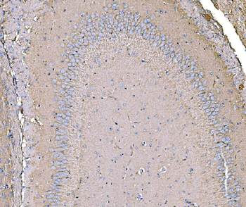IRBIT/AHCYL1 Rabbit Polyclonal Antibody