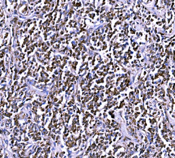 BCKDHA Antibody