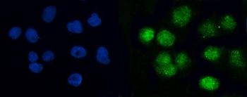 BRCC36/BRCC3 Rabbit Polyclonal Antibody