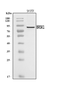 BRSK1 Rabbit Polyclonal Antibody