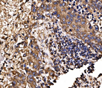 Calnexin/CANX Antibody