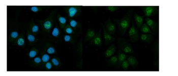 CBS Rabbit Polyclonal Antibody
