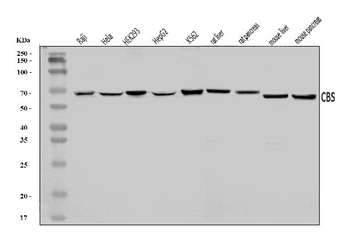 CBS Rabbit Polyclonal Antibody