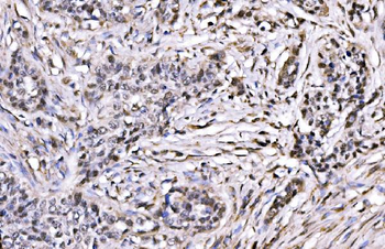 CBX1/HP1 beta Rabbit Polyclonal Antibody