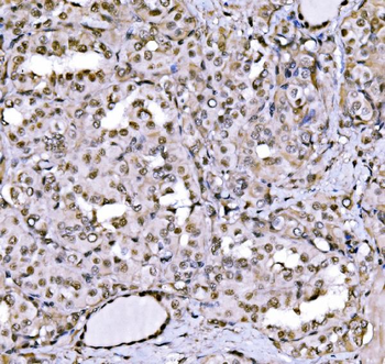 CBX1/HP1 beta Rabbit Polyclonal Antibody