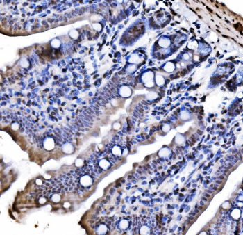 CBX1/HP1 beta Rabbit Polyclonal Antibody