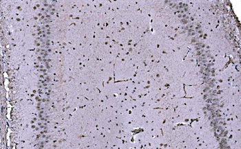 CBX1/HP1 beta Rabbit Polyclonal Antibody