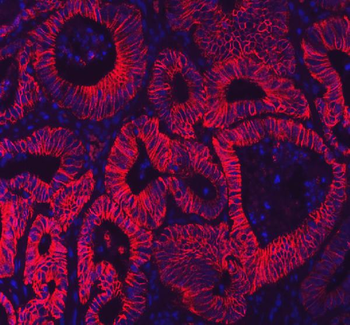 LI Cadherin/CDH17 Antibody