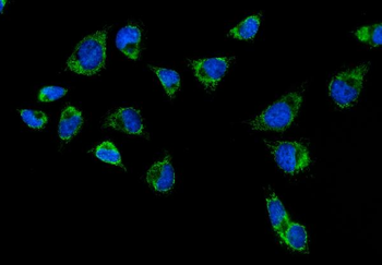 CPS1 Rabbit Polyclonal Antibody