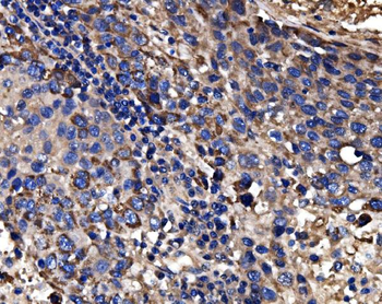 CPS1 Rabbit Polyclonal Antibody