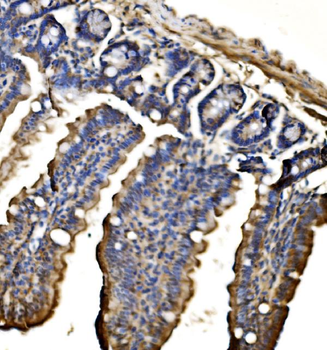 CPS1 Rabbit Polyclonal Antibody