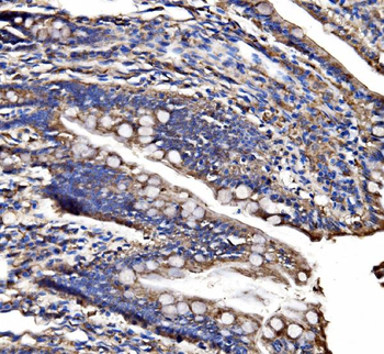 CPS1 Rabbit Polyclonal Antibody