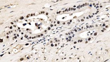 CPSF6 Rabbit Polyclonal Antibody