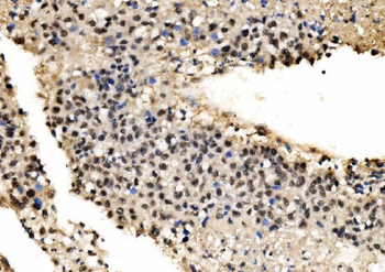 CPSF6 Rabbit Polyclonal Antibody