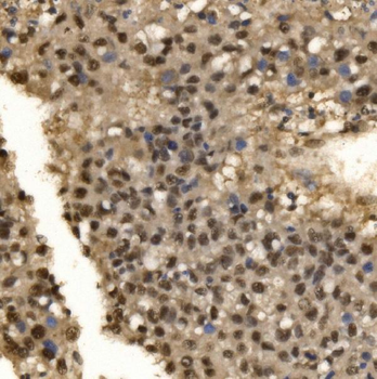 CPSF6 Rabbit Polyclonal Antibody