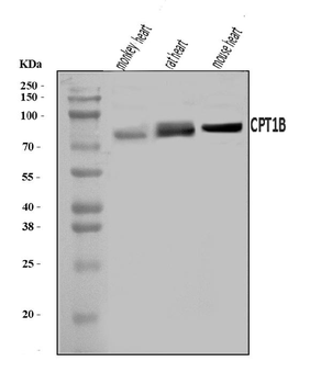 CPT1B Rabbit Polyclonal Antibody