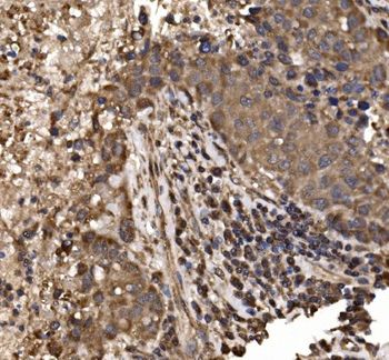 delta 1 Catenin/CAS/CTNND1 Rabbit Polyclonal Antibody