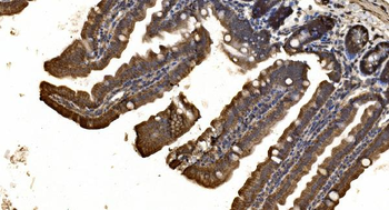delta 1 Catenin/CAS/CTNND1 Rabbit Polyclonal Antibody