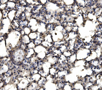 delta 1 Catenin/CAS/CTNND1 Rabbit Polyclonal Antibody