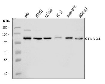 delta 1 Catenin/CAS/CTNND1 Rabbit Polyclonal Antibody