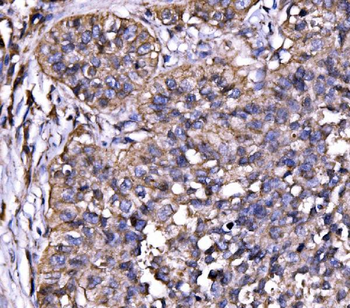 Drebrin/DBN1 Antibody
