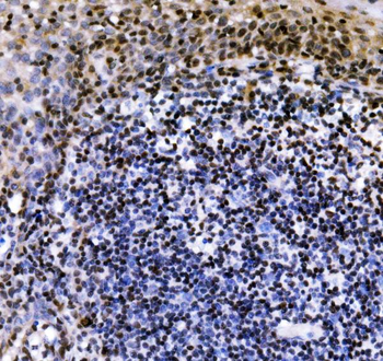 VPRBP/DCAF1 Rabbit Polyclonal Antibody