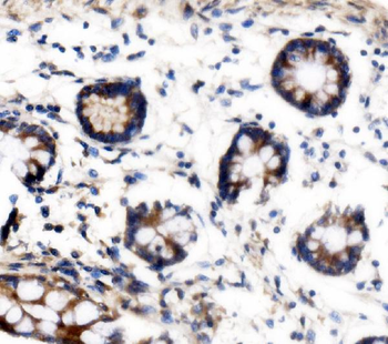 VPRBP/DCAF1 Rabbit Polyclonal Antibody