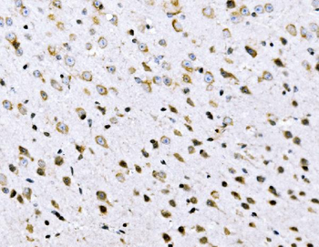 VPRBP/DCAF1 Rabbit Polyclonal Antibody