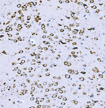 VPRBP/DCAF1 Rabbit Polyclonal Antibody