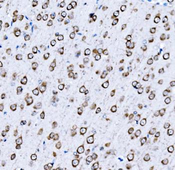 VPRBP/DCAF1 Rabbit Polyclonal Antibody
