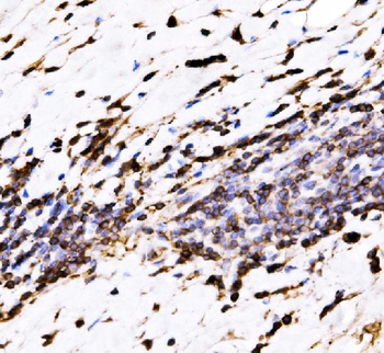 EVL Rabbit Polyclonal Antibody