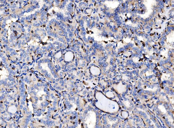 EVL Rabbit Polyclonal Antibody