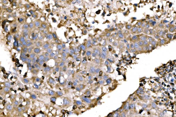 EVL Rabbit Polyclonal Antibody