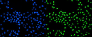 EXOSC3 Rabbit Polyclonal Antibody