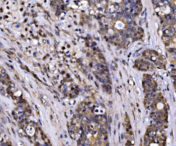 EXOSC3 Rabbit Polyclonal Antibody