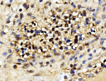 EXOSC3 Rabbit Polyclonal Antibody