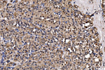 EXOSC3 Rabbit Polyclonal Antibody