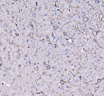 FXR1 Rabbit Polyclonal Antibody