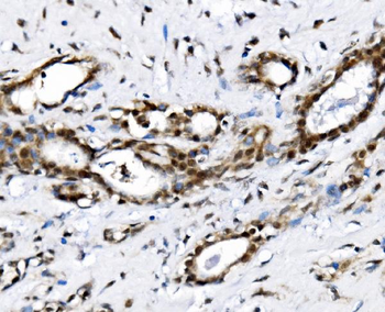 NOLA1/GAR1 Rabbit Polyclonal Antibody