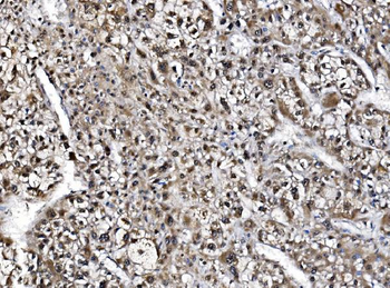 NOLA1/GAR1 Rabbit Polyclonal Antibody