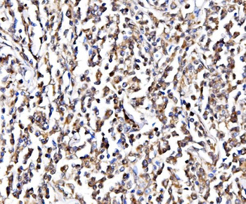 NOLA1/GAR1 Rabbit Polyclonal Antibody