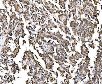 NOLA1/GAR1 Rabbit Polyclonal Antibody