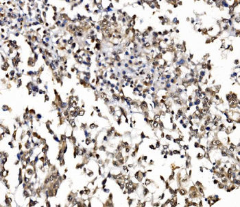 NOLA1/GAR1 Rabbit Polyclonal Antibody
