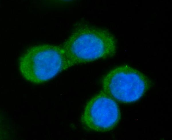 GGCX Rabbit Polyclonal Antibody