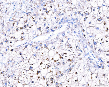 GGCX Rabbit Polyclonal Antibody