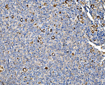 Glycogen synthase 1/GYS1 Rabbit Polyclonal Antibody