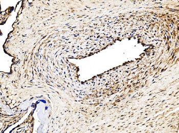 Glycogen synthase 1/GYS1 Rabbit Polyclonal Antibody