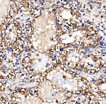 Glycogen synthase 1/GYS1 Rabbit Polyclonal Antibody